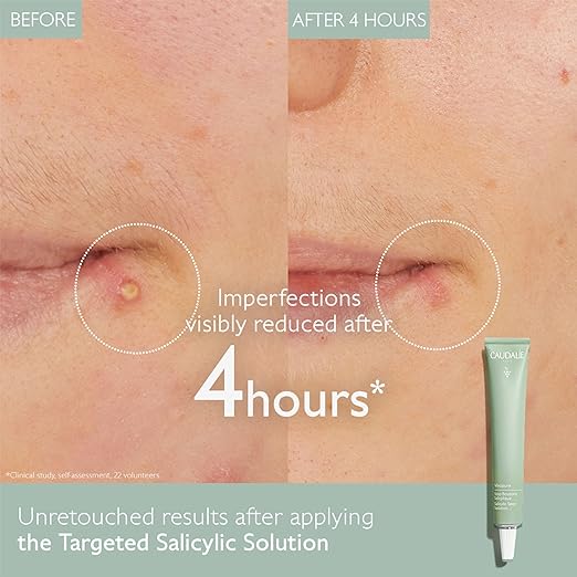 Vinopure Salicylic Spot Solution