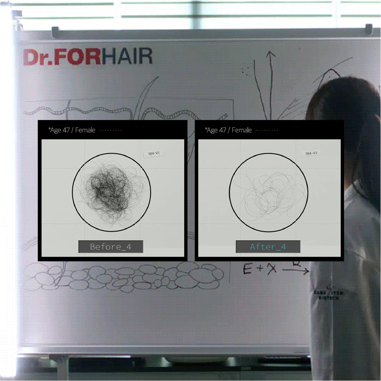Bio-3 Folligen Shampoo