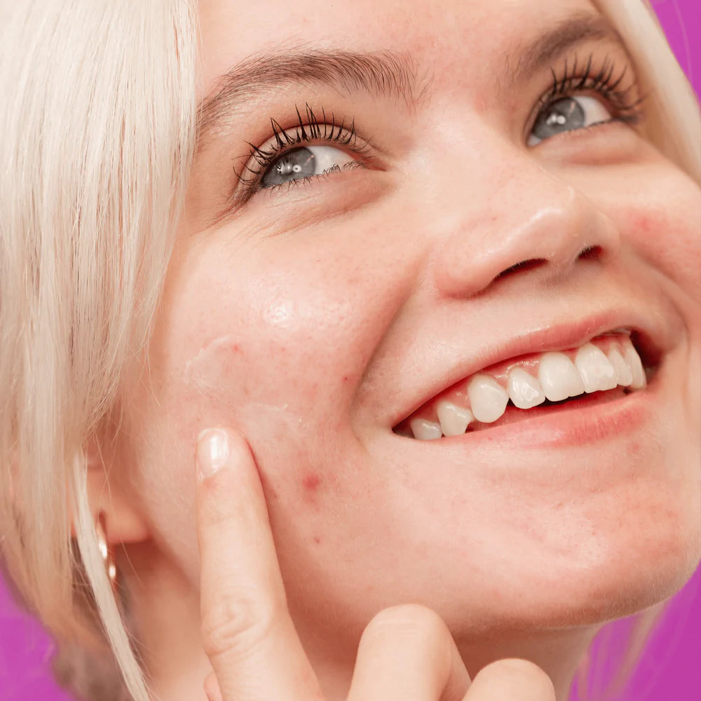 Breakout Clearing Kit