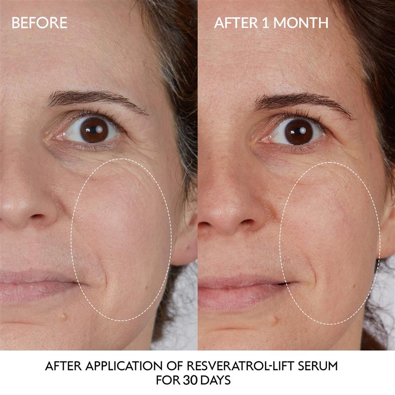 Resveratrol-lift Instant Firming Serum